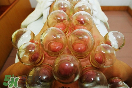 拔罐后皮膚發(fā)癢是怎么回事？拔罐后為什么皮膚會(huì)癢？