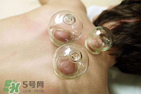 拔火罐后皮膚癢正常嗎？拔火罐后皮膚癢什么原因？