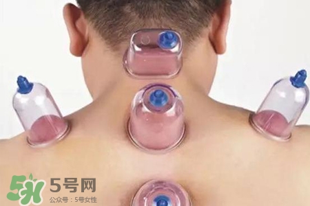 拔罐后可以喝酒嗎？拔罐后多久能喝酒？