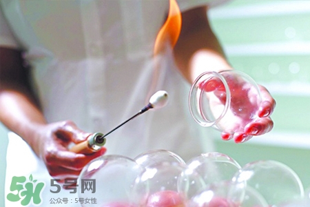 拔罐胃口會變好嗎？拔罐胃口變好怎么回事？