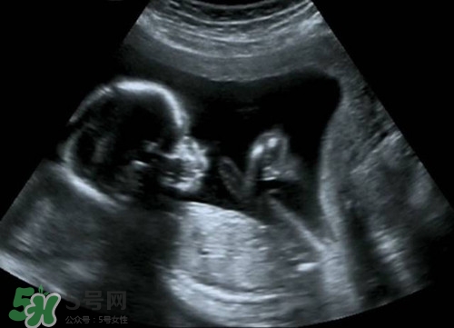 懷孕多久可以做b超?懷孕做b超對(duì)胎兒有影響嗎 懷孕多久可以做b超?懷孕做b超對(duì)胎兒有影響嗎