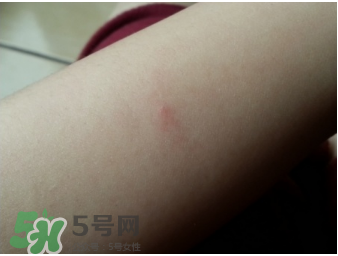 理膚泉b5修復(fù)霜怎么樣？理膚泉b5可以天天用嗎？