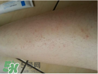 理膚泉b5修復(fù)霜怎么樣？理膚泉b5可以天天用嗎？