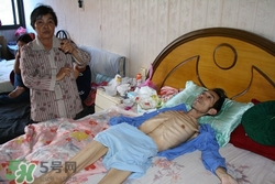 肝癌最多能活多長時間?肝癌早期治愈嗎 肝癌最多能活多長時間?肝癌早期治愈嗎