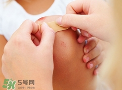 創(chuàng)可貼多久換一次?創(chuàng)可貼多長時間換一次? 創(chuàng)可貼多久換一次?創(chuàng)可貼多長時間換一次?