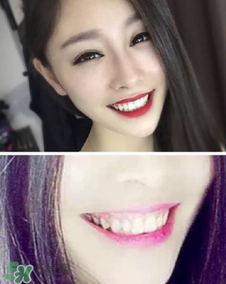 碧緹福冷光牙齒美白儀怎么用？碧緹福冷光牙齒美白儀使用方法