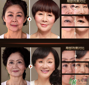 梵西六勝肽怎么樣？梵西六勝肽效果好嗎？