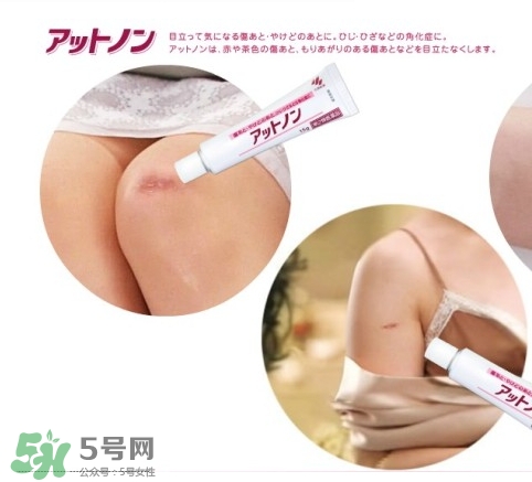 小林制藥去疤膏怎么用？小林制藥去疤膏說明書