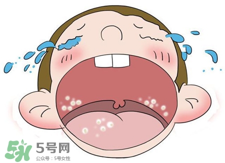 鵝口瘡是上火嗎?鵝口瘡是怎么引起的? 鵝口瘡是上火嗎?鵝口瘡是怎么引起的?