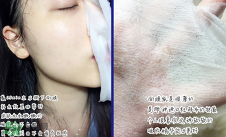 稚優(yōu)泉面膜怎么用？稚優(yōu)泉面膜要洗嗎？