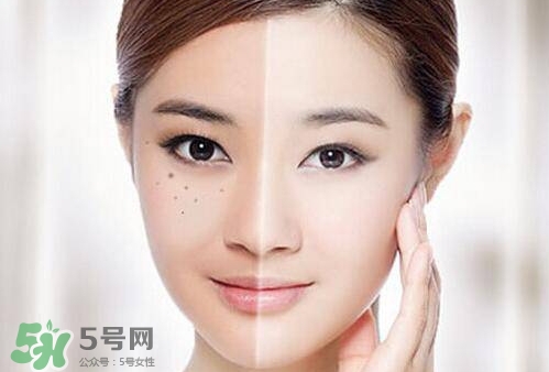 激光祛斑后多久能化妝?激光祛斑后多久可以化妝? 激光祛斑后多久能化妝?激光祛斑后多久可以化妝?