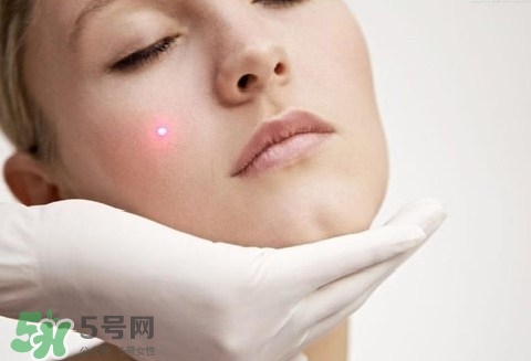 激光祛斑后吃什么才能恢復(fù)快點?激光祛斑后吃什么好? 激光祛斑后吃什么才能恢復(fù)快點?激光祛斑后吃什么好?