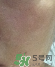 skin1004是什么牌子？skin1004屬于什么檔次