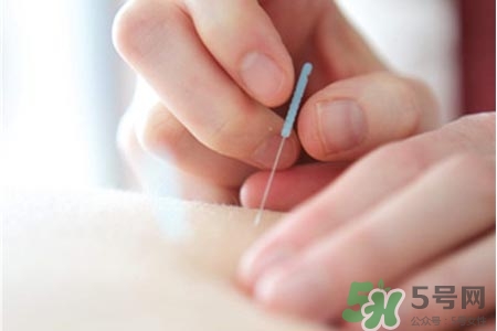 腰間盤(pán)突出可以針灸嗎？針灸能治腰間盤(pán)突出嗎？