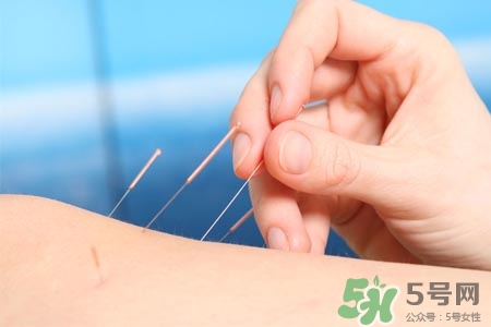 腰間盤(pán)突出可以針灸嗎？針灸能治腰間盤(pán)突出嗎？