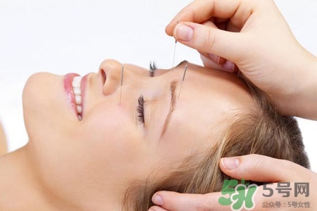 腰間盤(pán)突出可以針灸嗎？針灸能治腰間盤(pán)突出嗎？