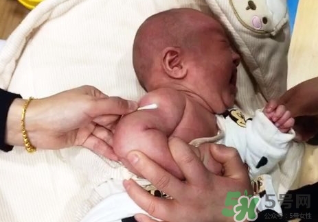 新生兒多少天打預(yù)防針?新生兒什么時(shí)候打預(yù)防針? 新生兒多少天打預(yù)防針?新生兒什么時(shí)候打預(yù)防針?