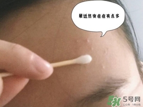 星期四農(nóng)莊茶樹精油怎么用？星期四農(nóng)莊茶樹精油使用方法