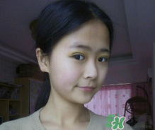 埋線雙眼皮需要拆線嗎？埋線雙眼皮怎么拆線