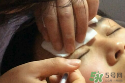 埋線雙眼皮需要拆線嗎？埋線雙眼皮怎么拆線