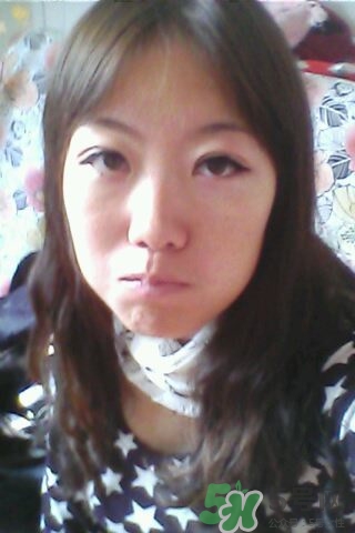 什么是定點雙眼皮？定點雙眼皮多少錢？