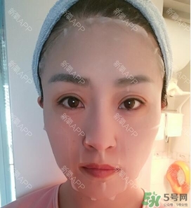 埋線雙眼皮能保持多久？埋線雙眼皮是永久嗎