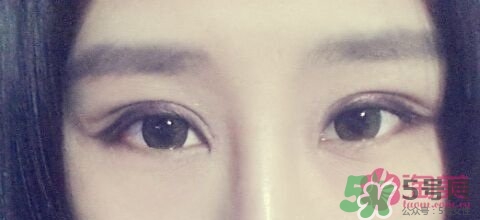 切開雙眼皮多久消腫？切開雙眼皮多久恢復(fù)？