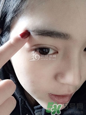 什么是定點雙眼皮？定點雙眼皮多少錢？