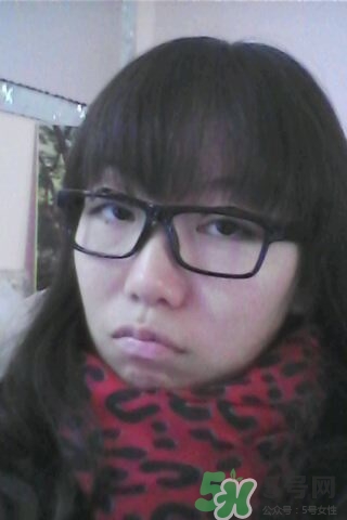 什么是定點雙眼皮？定點雙眼皮多少錢？