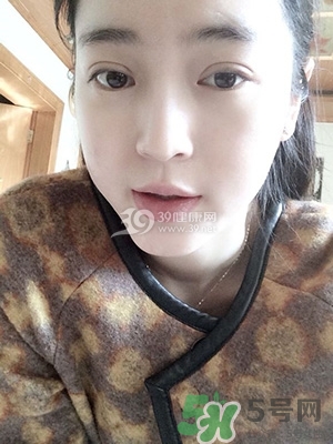 什么是定點雙眼皮？定點雙眼皮多少錢？