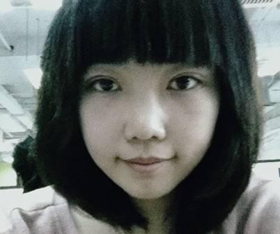 韓式三點(diǎn)雙眼皮是永久嗎？三點(diǎn)雙眼皮能保持多久？