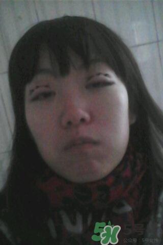 什么是定點雙眼皮？定點雙眼皮多少錢？