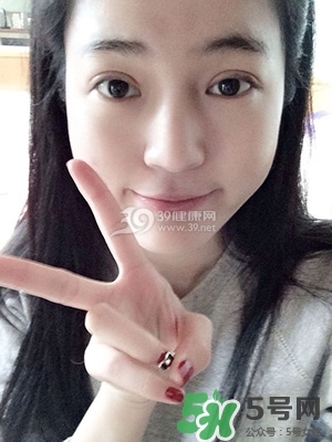 什么是定點雙眼皮？定點雙眼皮多少錢？