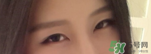 切開雙眼皮多久消腫？切開雙眼皮多久恢復(fù)？