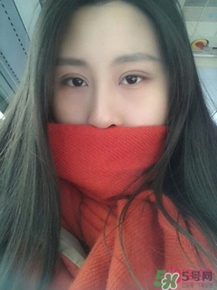 切開雙眼皮多久消腫？切開雙眼皮多久恢復(fù)？