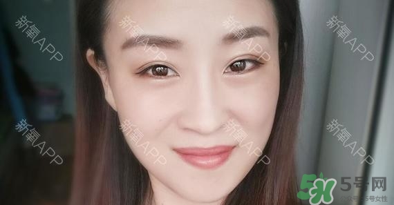 埋線雙眼皮能保持多久？埋線雙眼皮是永久嗎