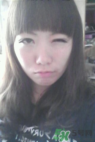 什么是定點雙眼皮？定點雙眼皮多少錢？