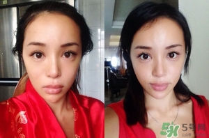 童顏針是什成分?童顏針和玻尿酸的區(qū)別 童顏針是什成分?童顏針和玻尿酸的區(qū)別