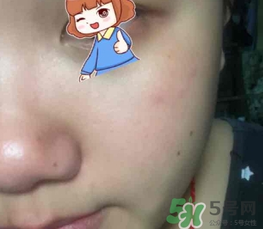 雙妹適合什么年齡？雙妹適合什么膚質(zhì)？