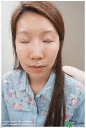 重瞼術(shù)多久能完全消腫 重瞼術(shù)恢復(fù)過程圖 重瞼術(shù)多久能完全消腫 重瞼術(shù)恢復(fù)過程圖