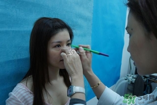 重瞼術是什么？重瞼術是永久的嗎？