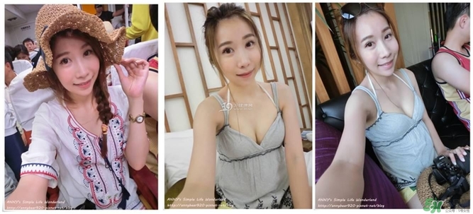 重瞼術(shù)多久能完全消腫 重瞼術(shù)恢復(fù)過程圖 重瞼術(shù)多久能完全消腫 重瞼術(shù)恢復(fù)過程圖