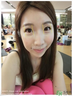 重瞼術(shù)多久能完全消腫 重瞼術(shù)恢復(fù)過程圖 重瞼術(shù)多久能完全消腫 重瞼術(shù)恢復(fù)過程圖