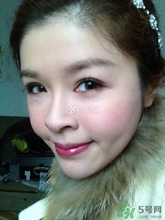 重瞼術是什么？重瞼術是永久的嗎？