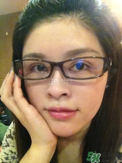 重瞼術是什么？重瞼術是永久的嗎？