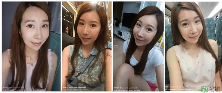 重瞼術(shù)多久能完全消腫 重瞼術(shù)恢復(fù)過程圖 重瞼術(shù)多久能完全消腫 重瞼術(shù)恢復(fù)過程圖