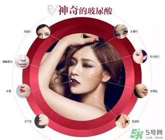 喬雅登是哪個(gè)國家的？喬雅登玻尿酸哪個(gè)國家？