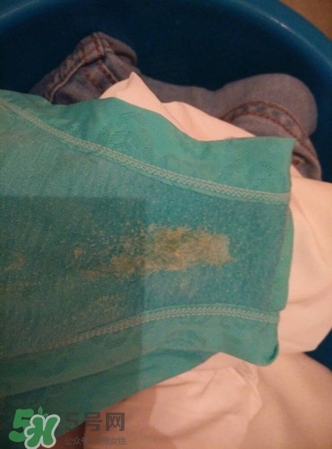 內褲精斑是什么樣子?精斑如何清洗 內褲精斑是什么樣子?精斑如何清洗