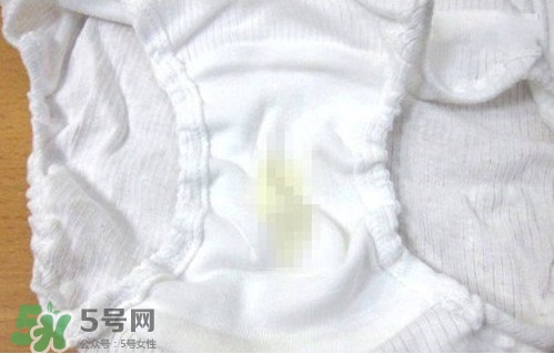 內褲精斑是什么樣子?精斑如何清洗 內褲精斑是什么樣子?精斑如何清洗