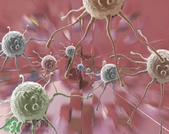 脂肪瘤是怎么形成的?脂肪瘤如何治療 脂肪瘤是怎么形成的?脂肪瘤如何治療